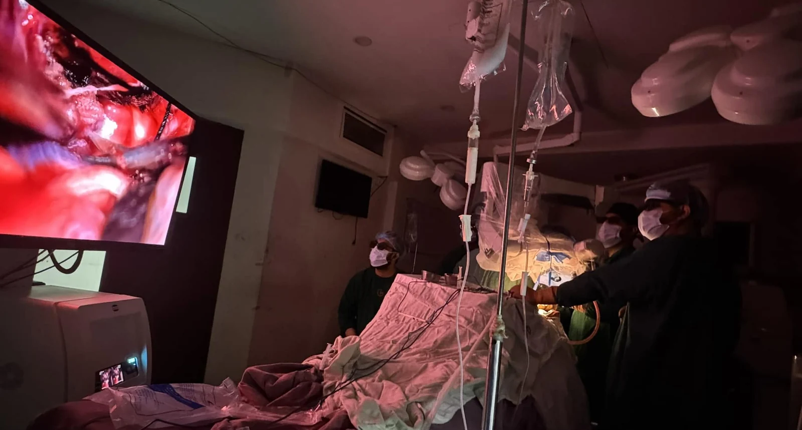 Surgeons working with endoscopic equipment and a surgical monitor
