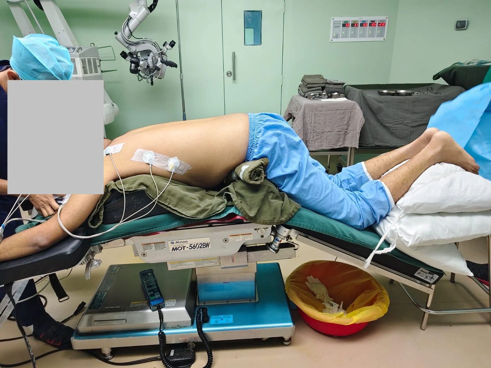 Patient positioning and anaesthesia equipment in the operating theatre